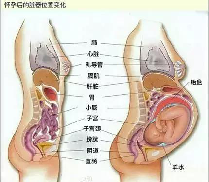 子宫脱垂