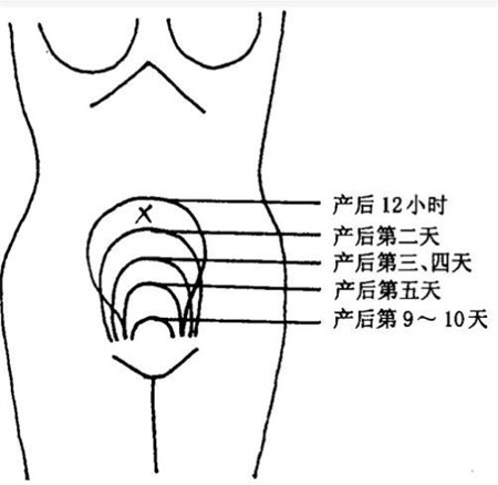 产后康复