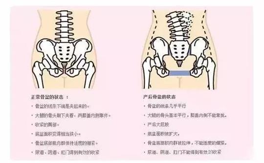 腹直肌修复